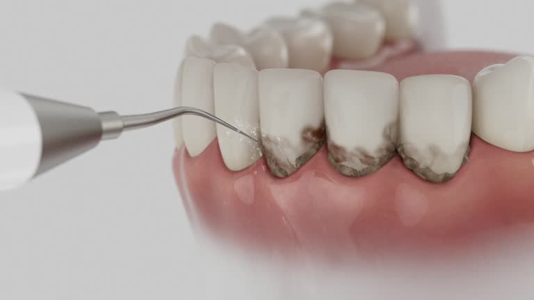 Reliable Tooth Extraction contractor in Jefferson Parish County, LA by Dentist Open Now